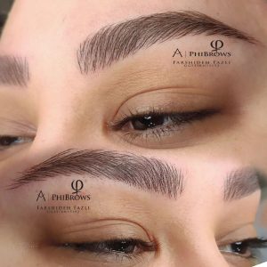 میکروبلیدینگ|  اجرای میکروبلیدینگ