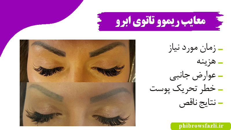معایب ریموو تاتوی ابرو