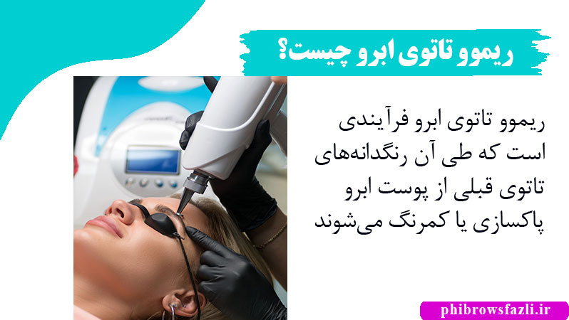 ریموو تاتوی ابرو چیست؟