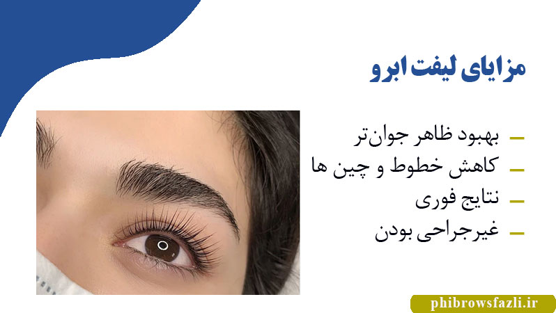 مزایای لیفت ابرو