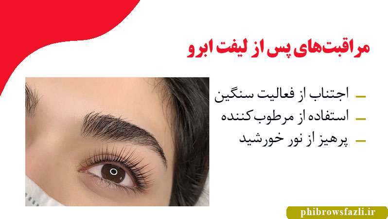 مراقبتهای پس از لیفت ابرو