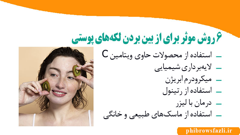 ۶ روش موثر برای از بین بردن لکههای پوستی