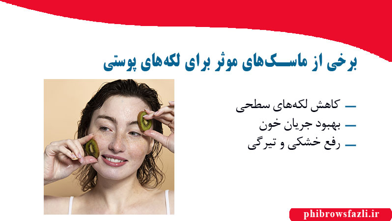 برخی از ماسکهای موثر برای لکههای پوستی