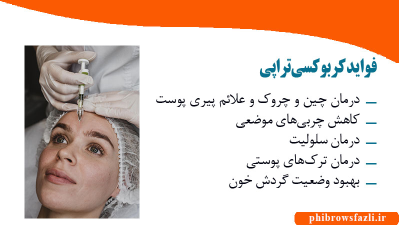 فواید کربوکسیتراپی