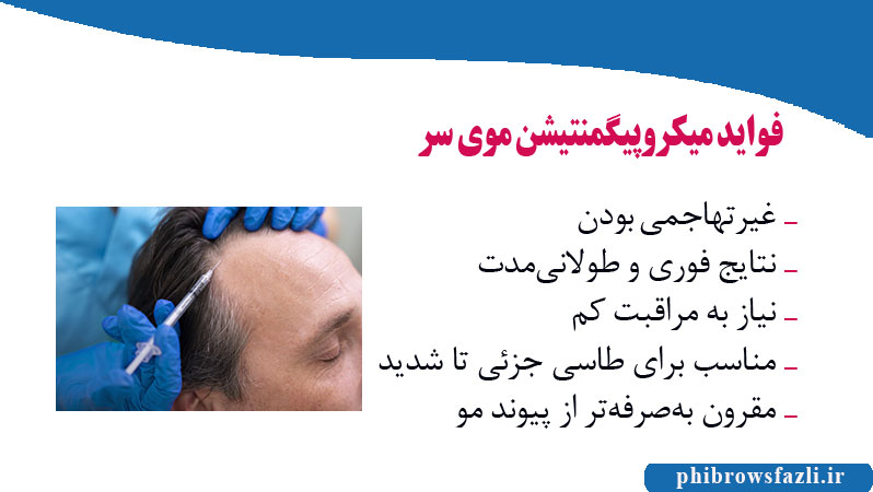فواید میکروپیگمنتیشن موی سر