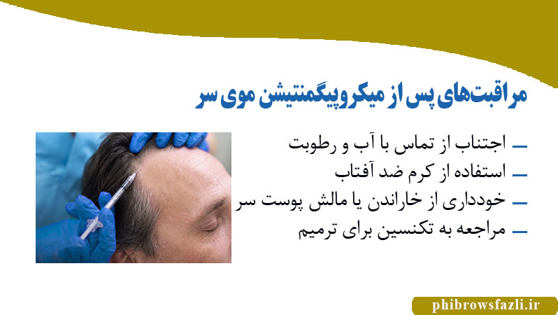 مراقبت‌های پس از میکروپیگمنتیشن موی سر