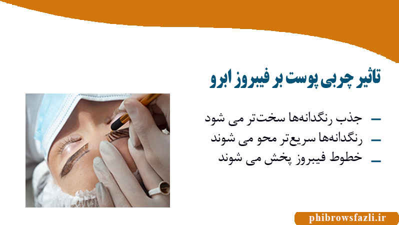 تاثیر چربی پوست بر فیبروز ابرو