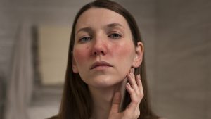 روش های کاربردی برای رفع خشکی پوست صورت