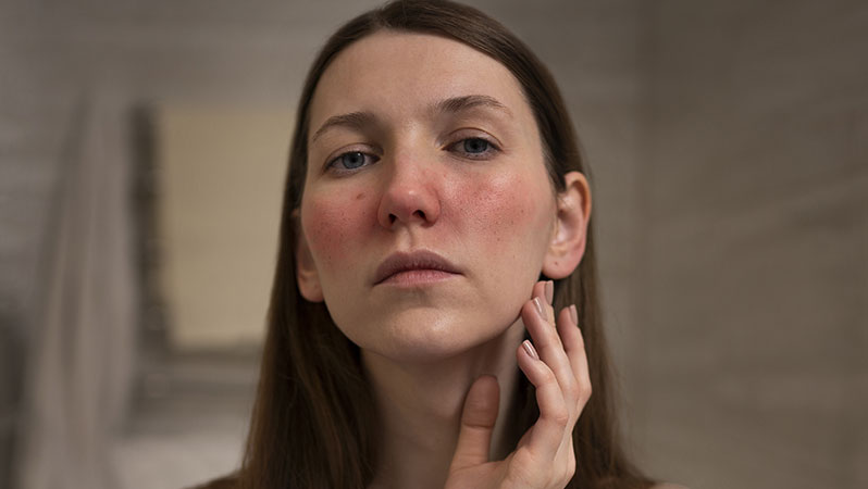 روش های کاربردی برای رفع خشکی پوست صورت