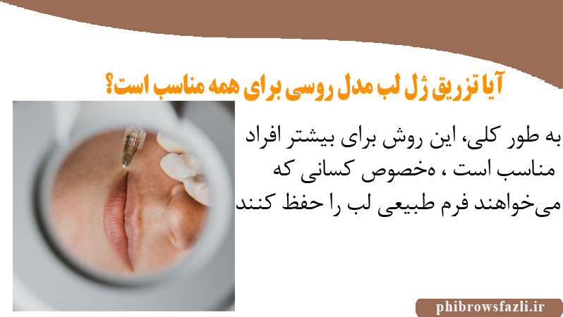 آیا تزریق ژل لب مدل روسی برای همه مناسب است؟