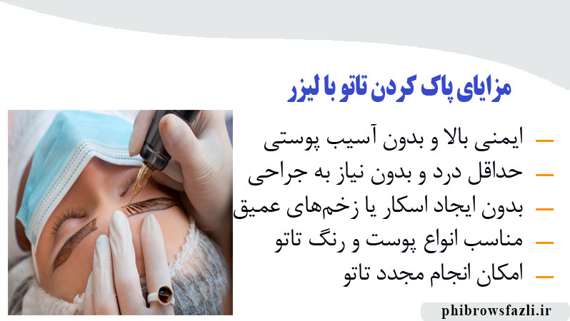 مزایای پاک کردن تاتو با لیزر