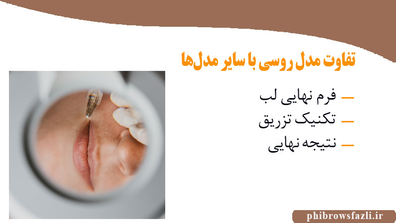 تفاوت مدل روسی با سایر مدل‌ها