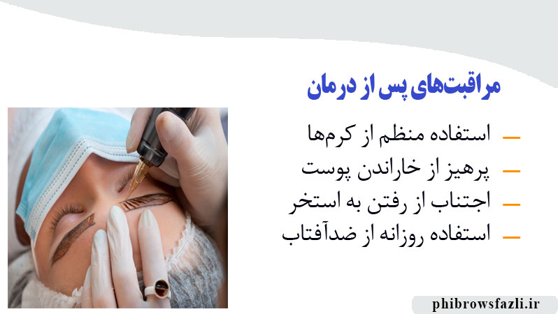 مراقبت‌های پس از درمان تاتو