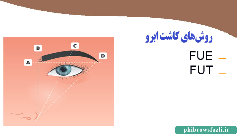روشهای کاشت ابرو
