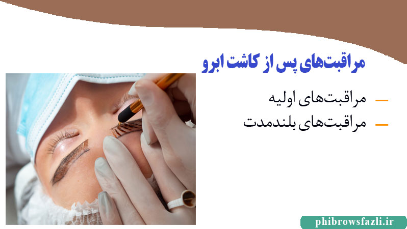 مراقبت‌های پس از کاشت ابرو