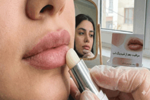 ترمیم شیدینگ لب