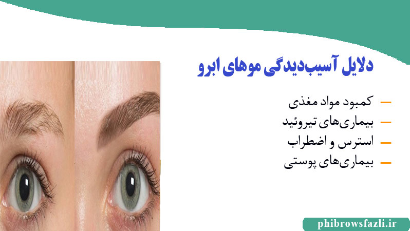 دلایل آسیبدیدگی موهای ابرو