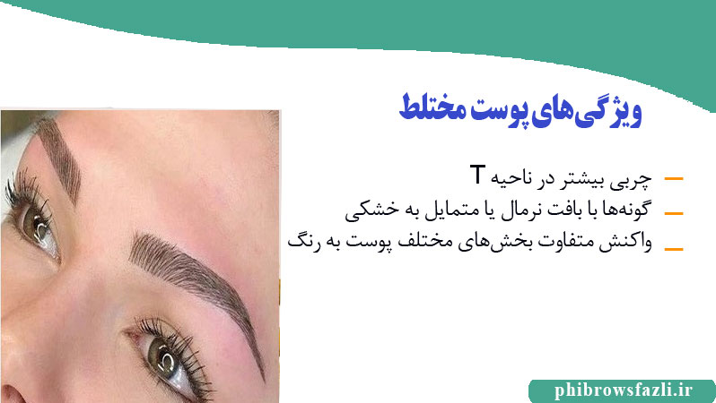 ویژگی‌های پوست مختلط