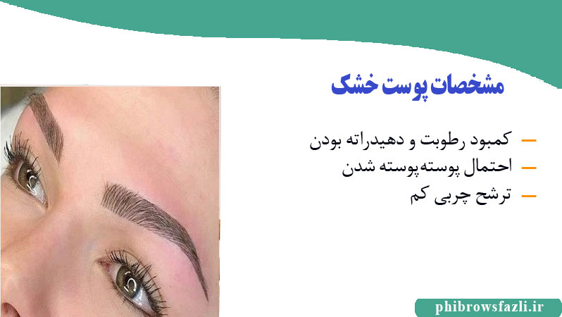 مشخصات پوست خشک