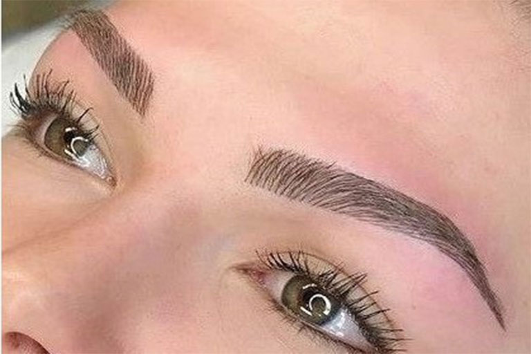 میکروبلیدینگ و نوع پوست